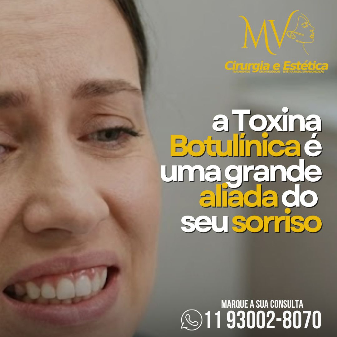Você mostra a gengiva quando sorri ?-Botos pode ajudar. Você mostra a gengiva quando sorri ?-Botos pode ajudar.
