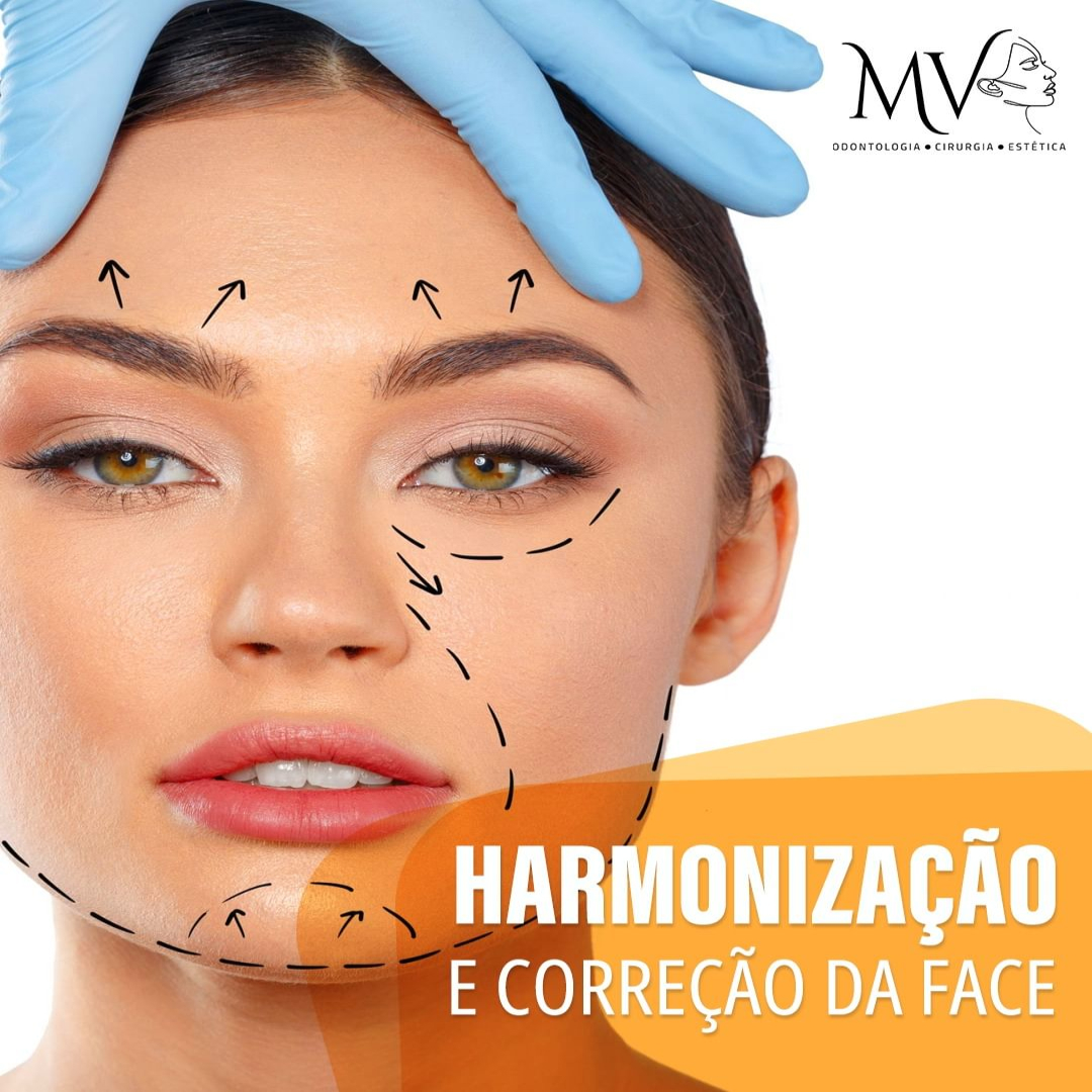 Harmonização e correção da face-Saiba mais