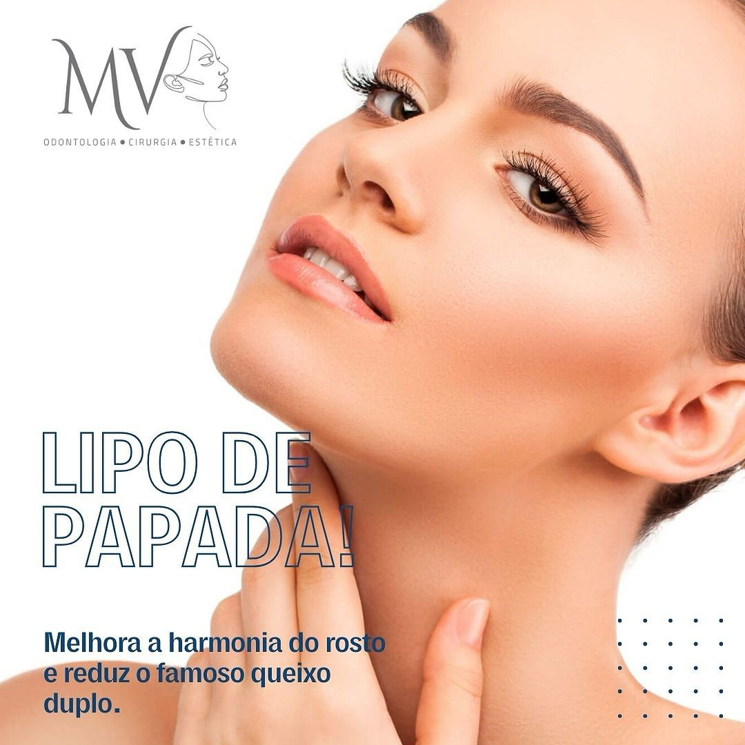Lipo de papada-Uma melhor harmonia no contorno de seu rosto