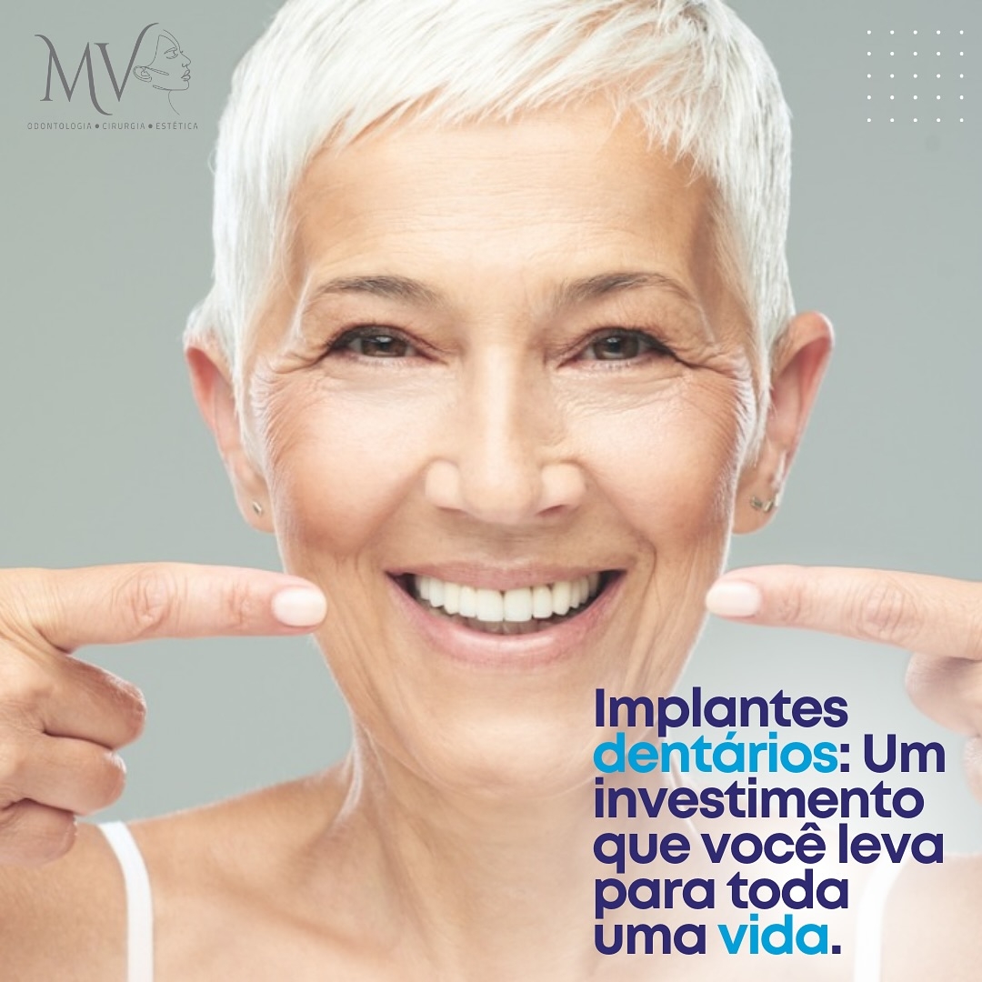 Implantes dentários-um grande investimento