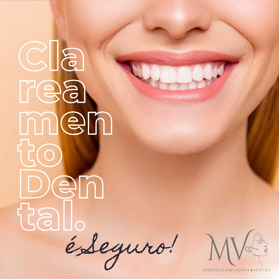 Clareamento Dental-Será que é seguro