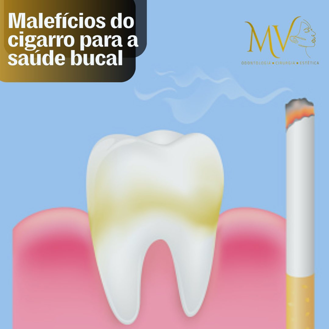 Malefícios do Cigarro para a saúde bucal-Saiba mais