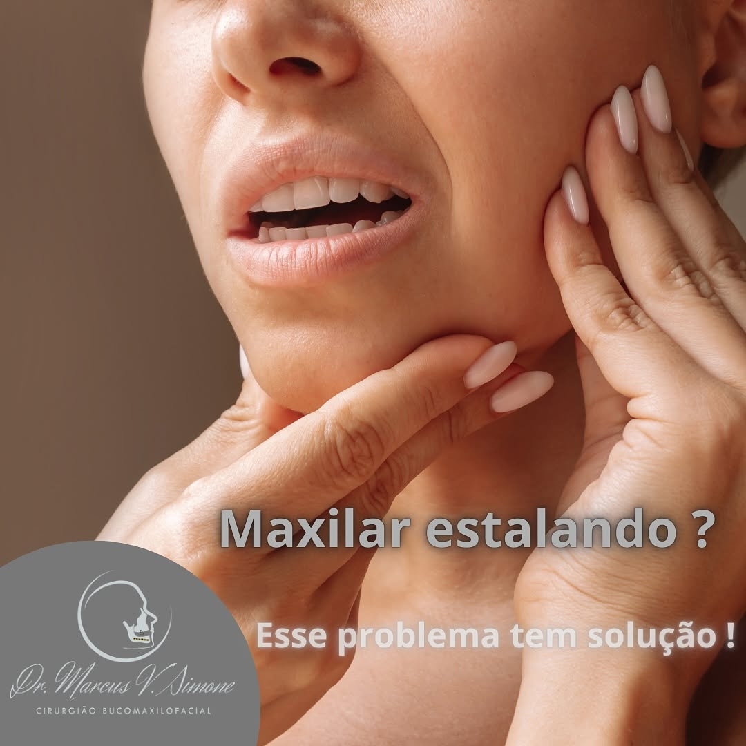 Maxilar estalando !-Esse problema tem solução
