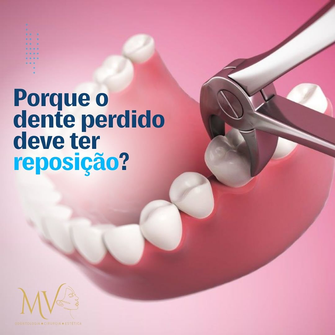 Reposição de dente perdido é necessária ?-Saiba Mais