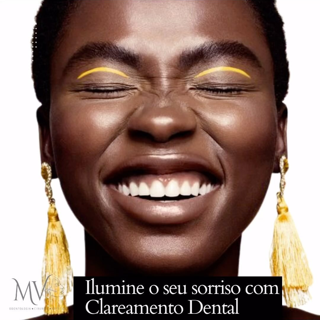 Clareamento dental-Ilumine mais o seu sorriso !