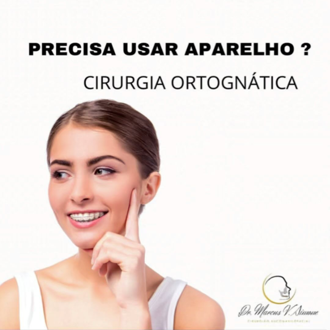 Precisa usar aparelho para fazer Cirurgia ortognática ?-Saiba mais