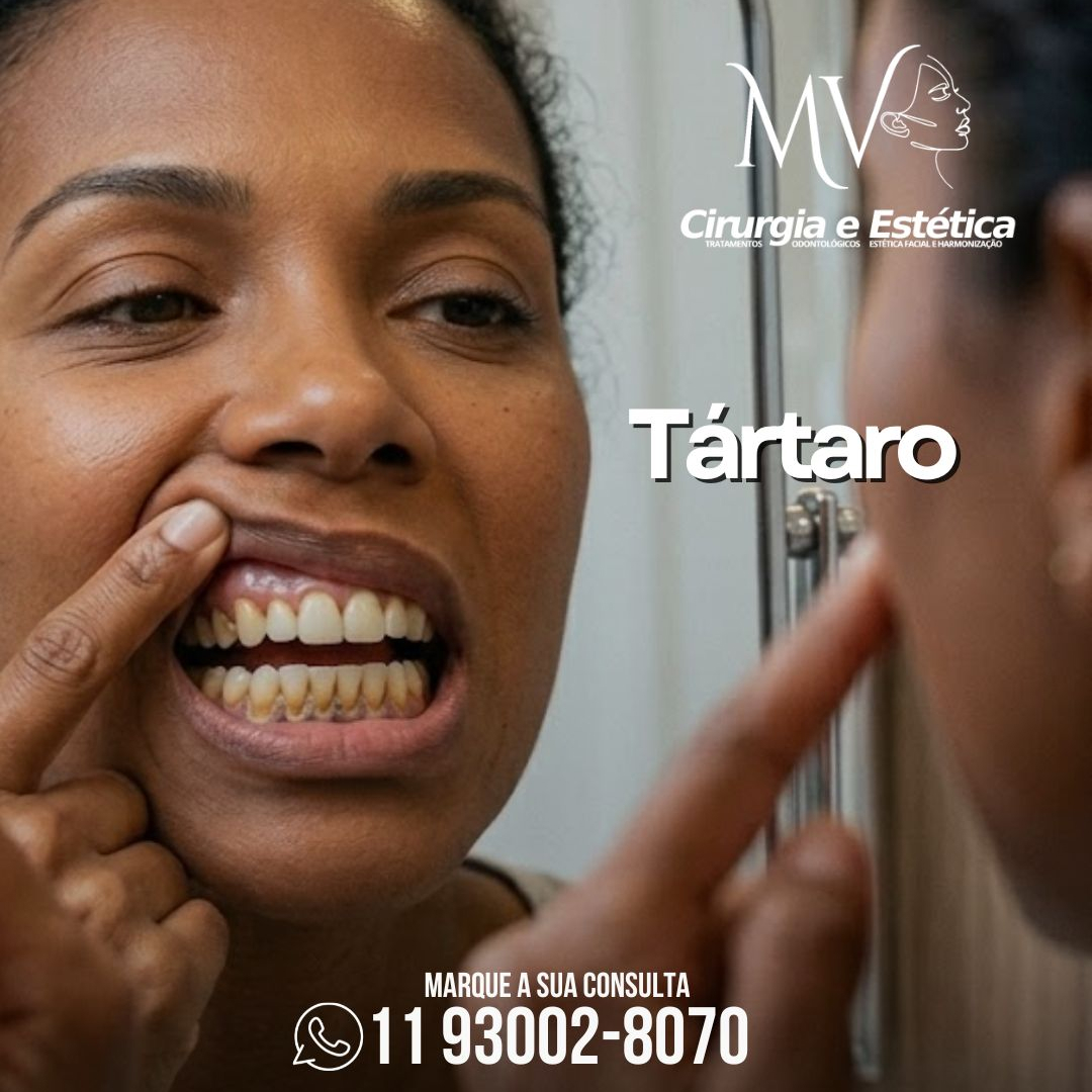 Tártaro-como se forma