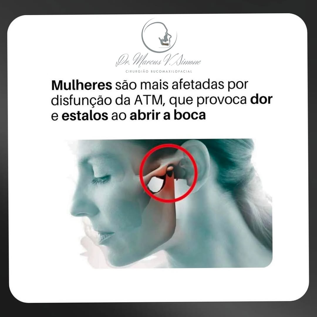 Mulheres e disfunção da ATM-Porque elas são mais afetadas