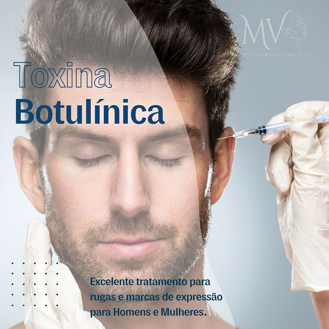 Toxina Botulínica-Tratamento para rugas e marcas de expressão