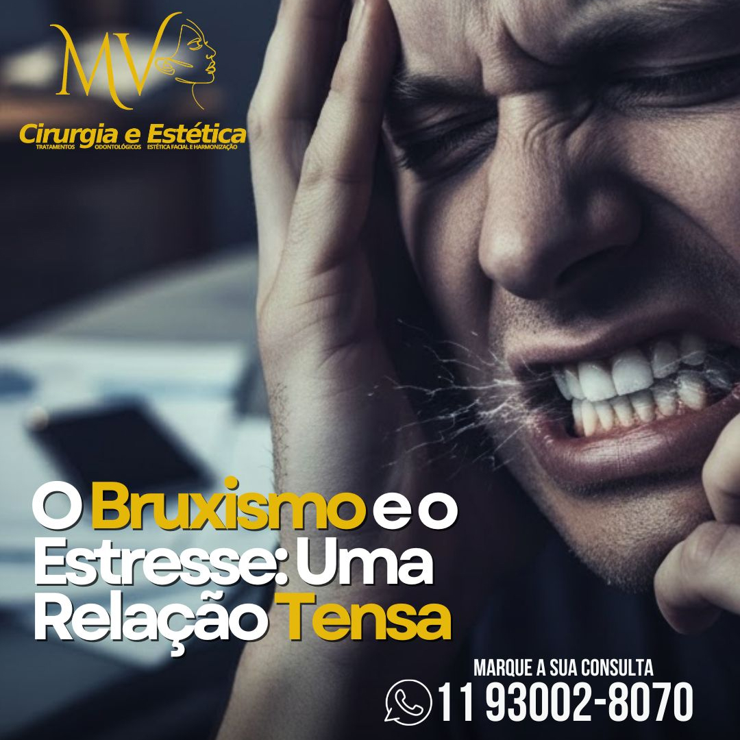 Bruxismo e Estresse-uma relação tensa Bruxismo e Estresse-uma relação tensa