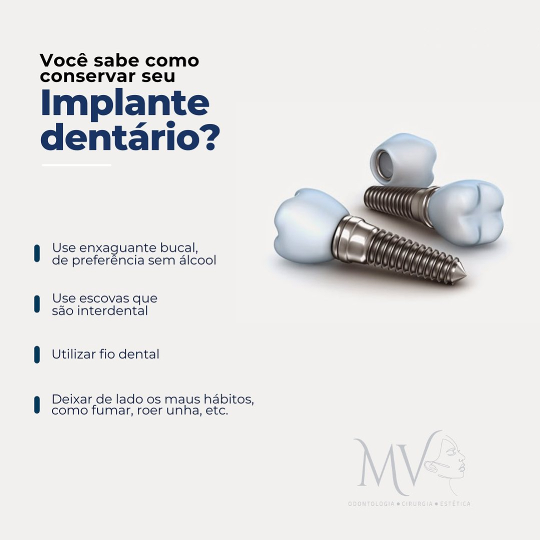 Como conservar seu implante ?-saiba mais