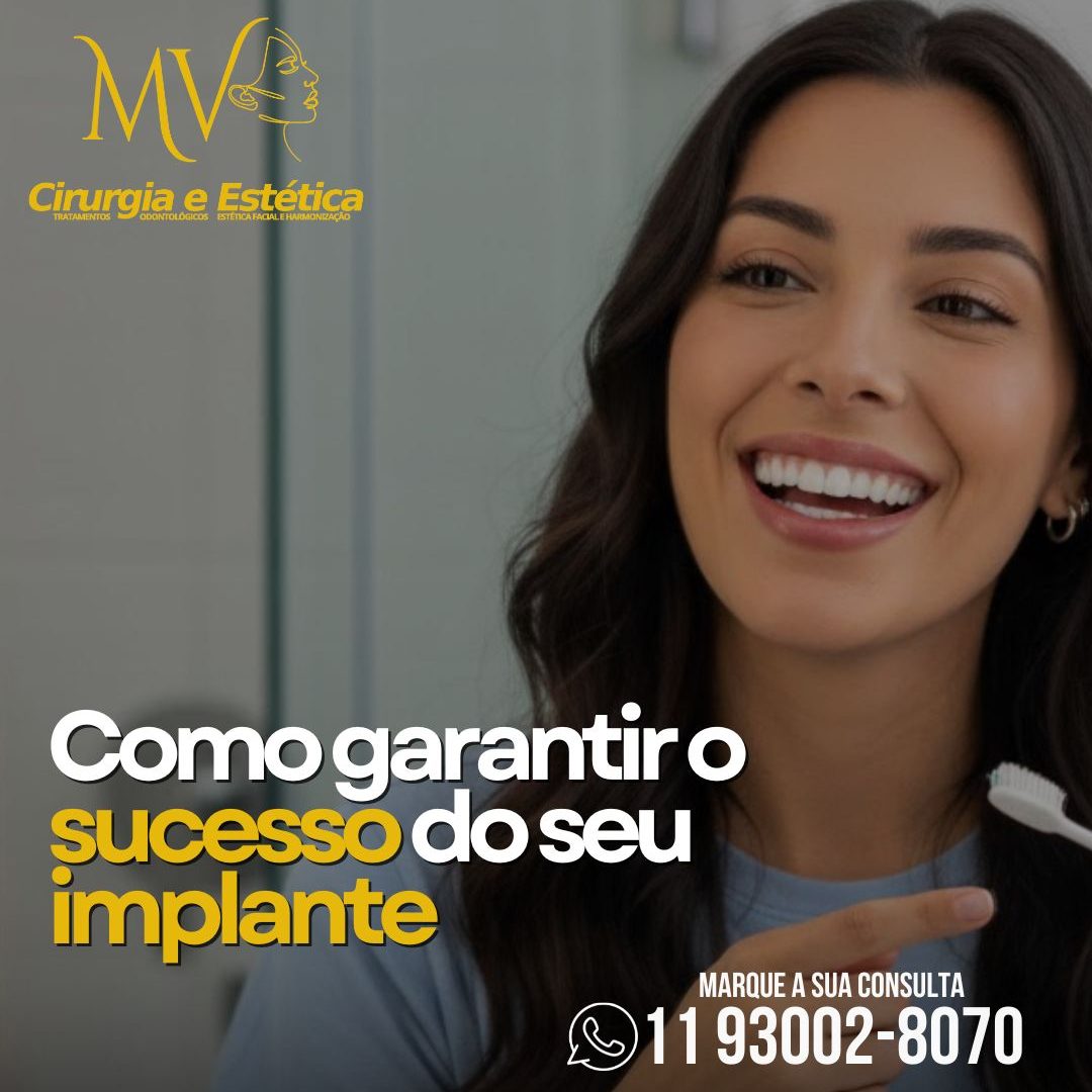 Com garantir o sucesso do seu implante-saiba mais Com garantir o sucesso do seu implante-saiba mais