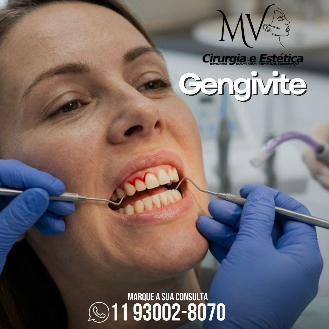 Gengivite-não ignore os sangramentos