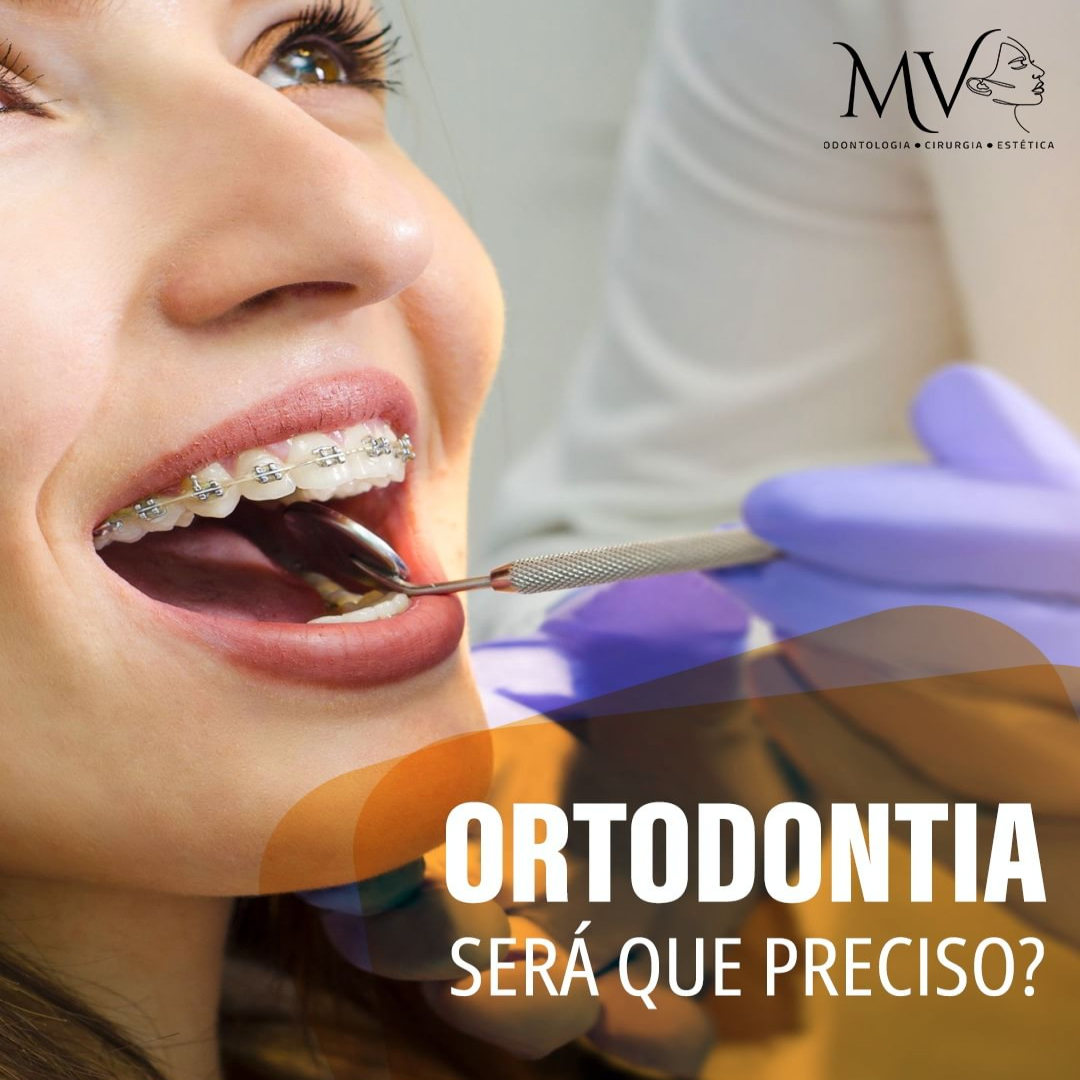 Ortodontia-Será que eu preciso ?