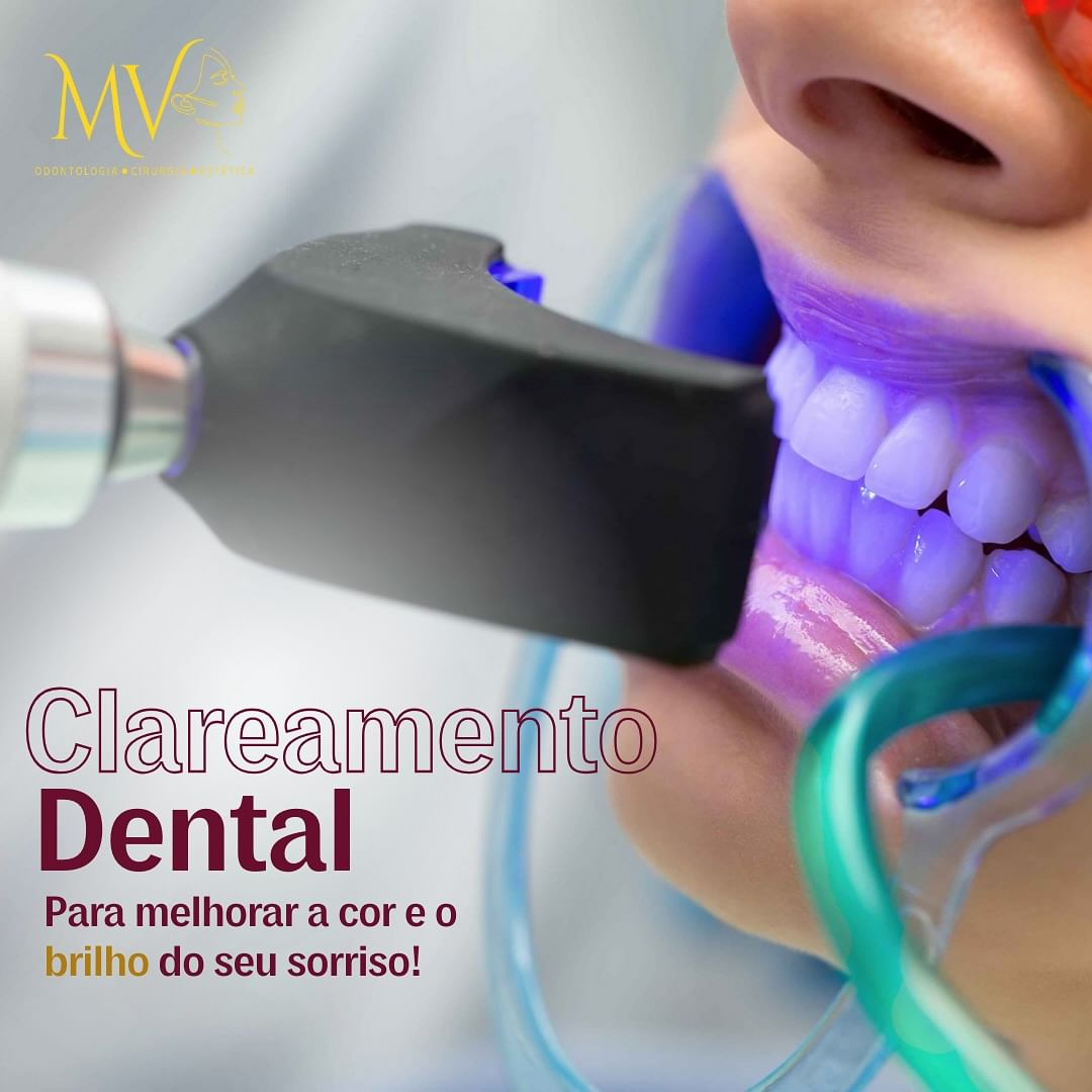 Clareamento Dental-Melhore a cor e o brilho do seu sorriso