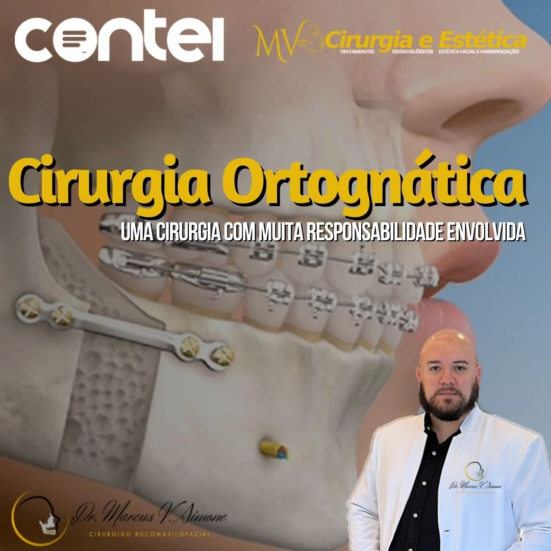Cirurgia Ortognática-A responsabilidade de quem faz