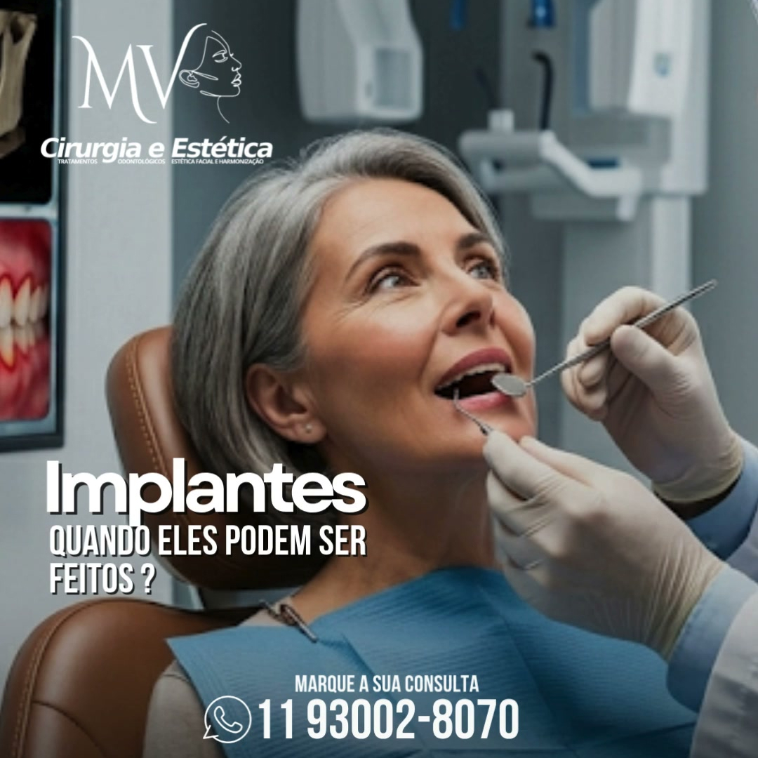 Implantes-quando eles podem ser feitos